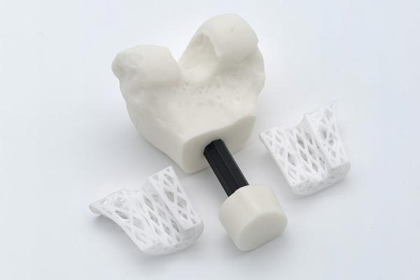 3D printed bioresorbalbe implants